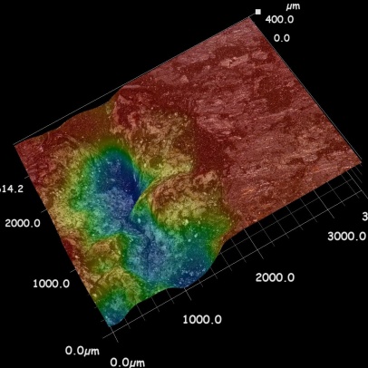 3D map of surface morphology created using a digital confocal microscope.